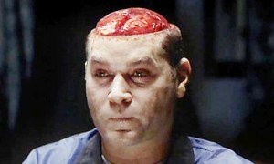 Hannibal Liotta Brain